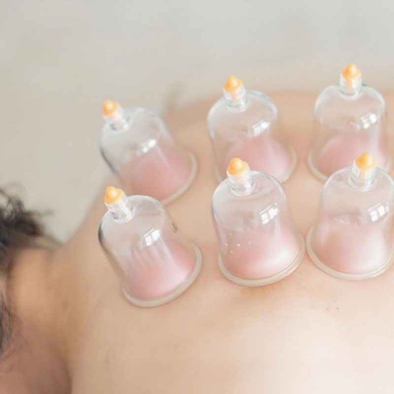 Body Cupping Glasgow